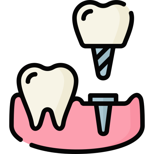Implant Placement